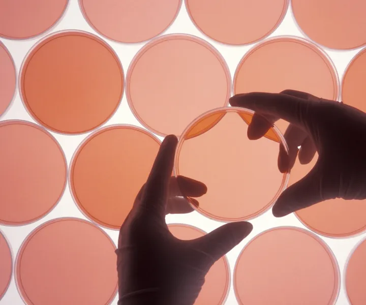 pink colored petri dishes