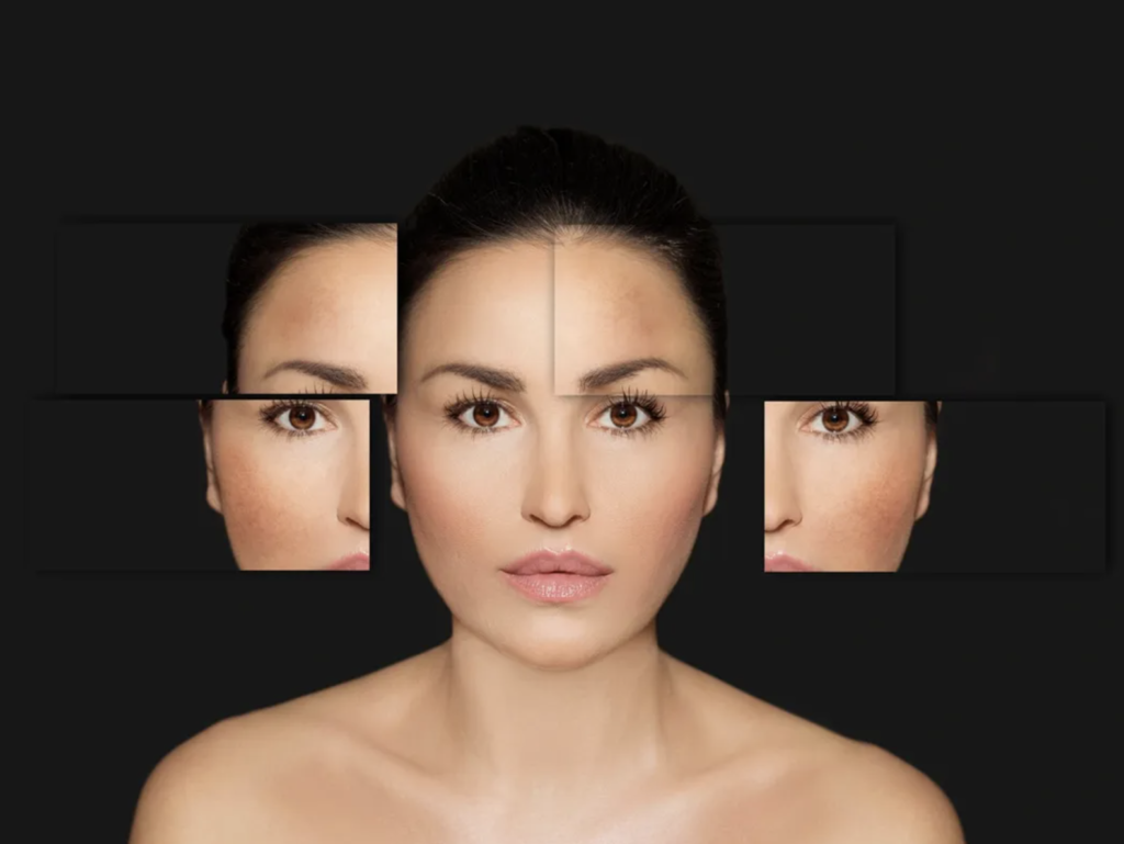 Morpheus8 Facial Shot