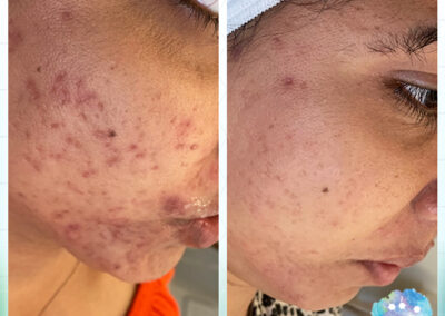 Rejuvenation Skin Lab - Before & After