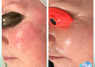 Rejuvenation Skin Lab - Before & After