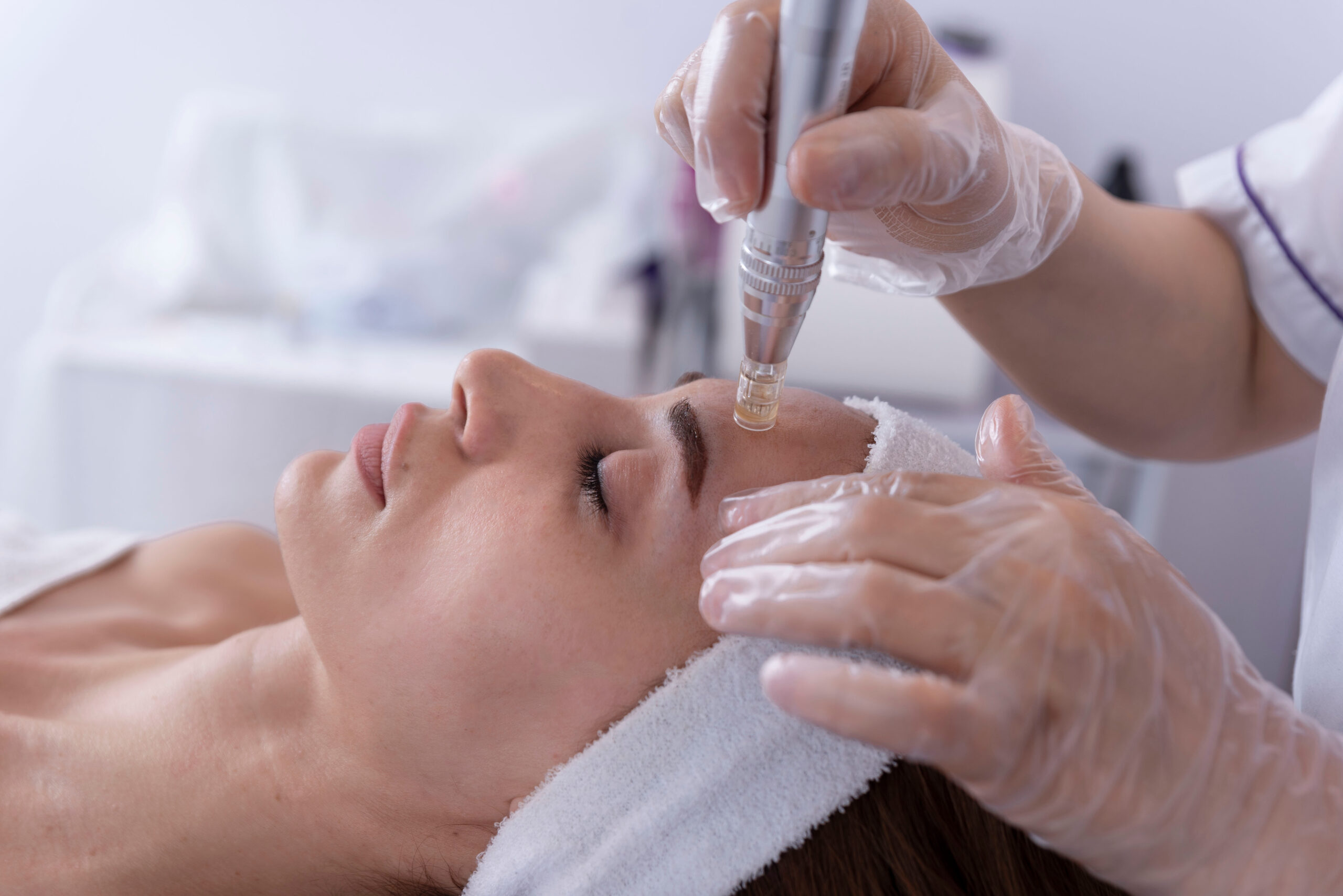 close up of Cosmetologist,beautician applying facial dermapen tr microneedling