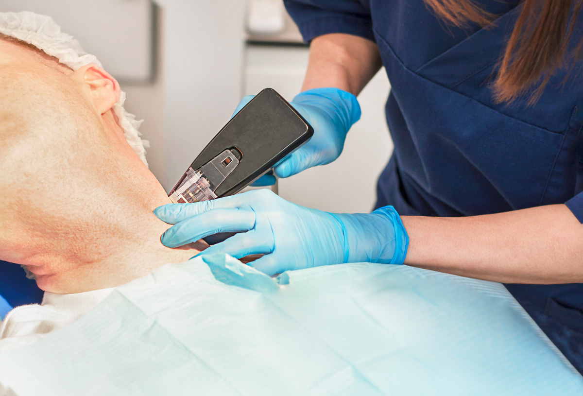 A professional performing Morpheus8 skin treatment on a patient’s neck in Richmond.