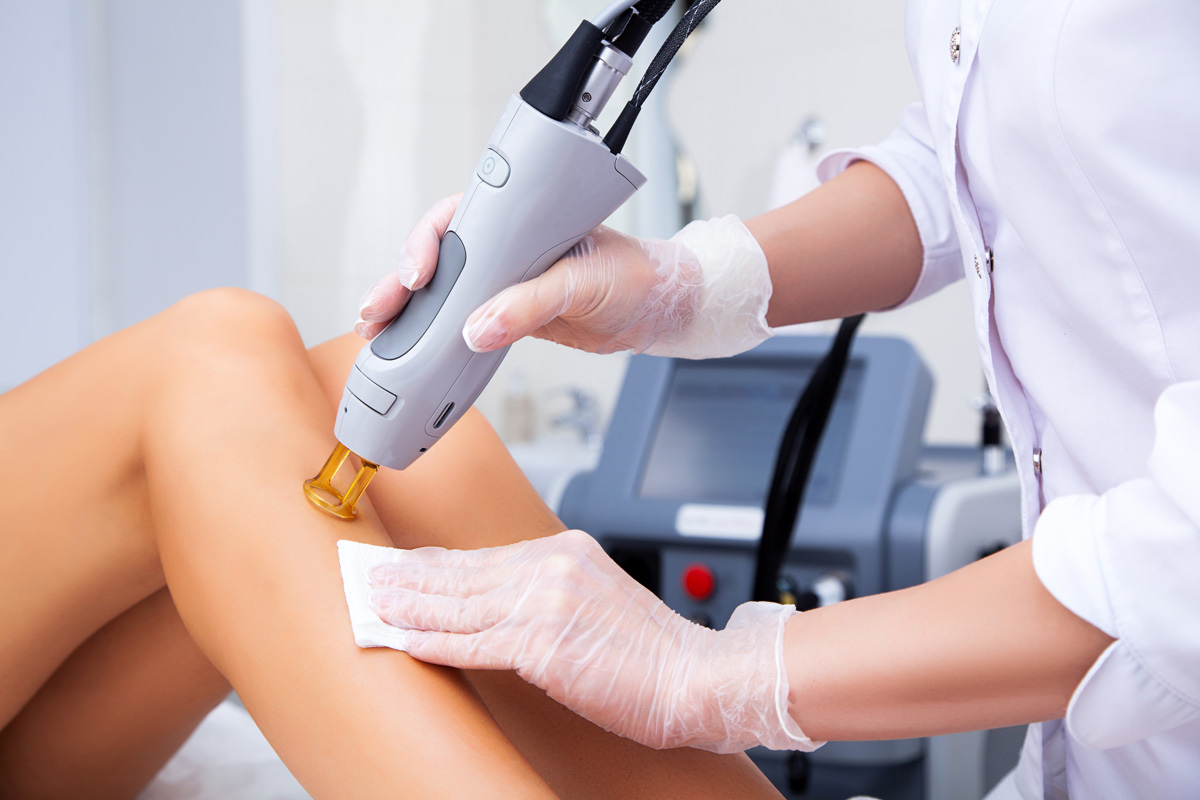 A professional performing laser hair removal on a patient’s leg.